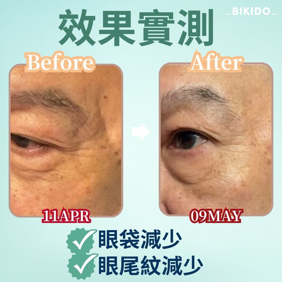 Customer-submitted before and after photos of the eye area dated 11 April and 9 May, reporting reduced eye bags and crow's feet. Pterostilbene absorbs more readily than resveratrol, and spermidine supports cellular renewal