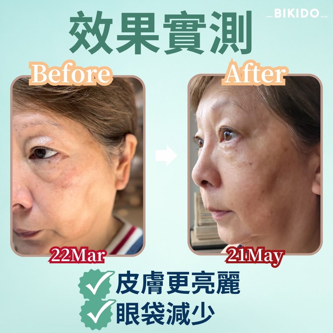 Customer-submitted before and after photos dated 22 March and 21 May, reporting brighter skin and reduced eye bags. PQQ in the formula supports mitochondrial function and provides antioxidant protection